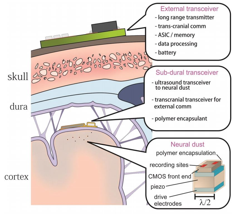 Illustration for article titled Neural Dust is a Step Towards Nexus